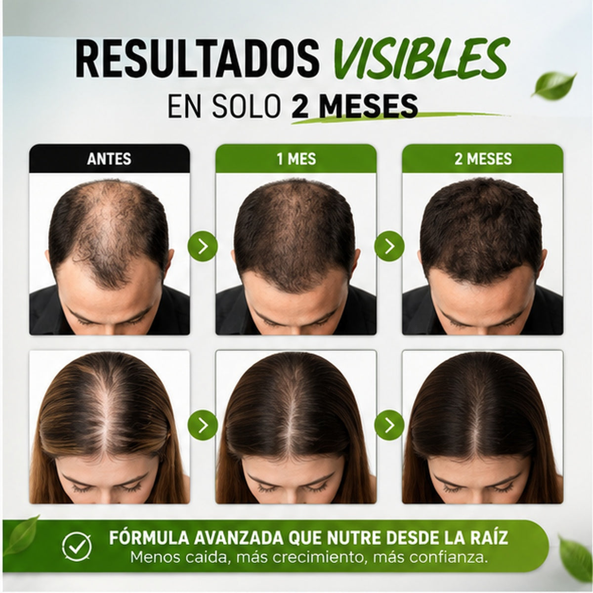Shampoo Anticaída® - ¡Dile adiós a tus entradas!