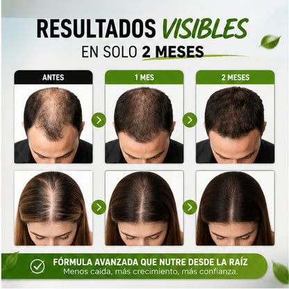 Shampoo Anticaída® - ¡Dile adiós a tus entradas!