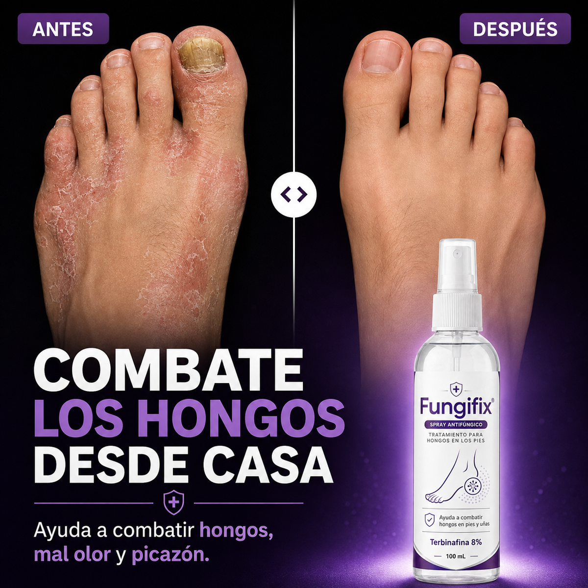 FungiFix® - Spray Antihongos Avanzado